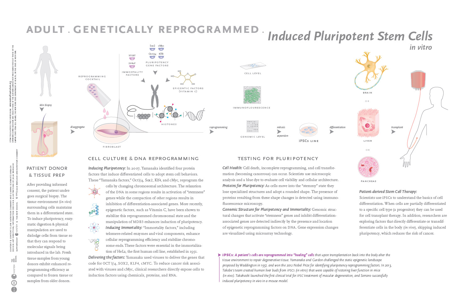 infographic